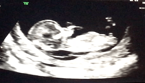 Screen Shot 2018-10-27 at 9.14.38 AM